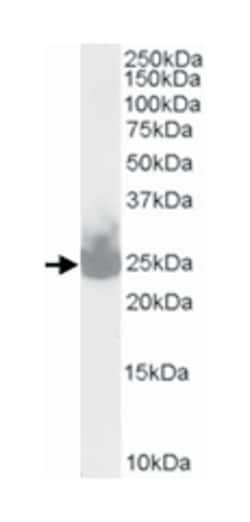 SNAP25, Goat, Polyclonal Antibody, Abnova 100 &mu;g | Buy Online | Abnova Corporation | Fisher Scientific