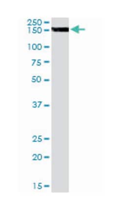 EPB41L3, Goat, Polyclonal Antibody, Abnova 100&mu;g; Unlabeled:Antibodies,