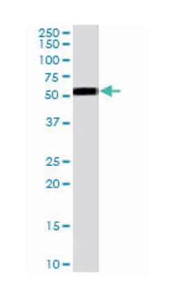 ZMPSTE24, Goat, Polyclonal Antibody, Abnova 100&mu;g; Unlabeled:Antibodies,