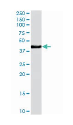 NHEJ1, Goat, Polyclonal Antibody, Abnova 100 &mu;g | Buy Online | Abnova | Fisher Scientific
