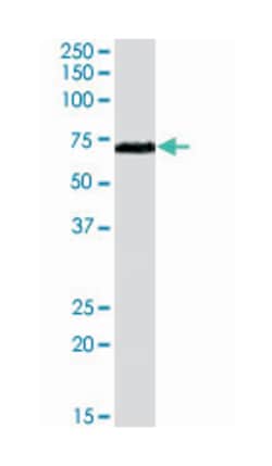RAD9A, Goat, Polyclonal Antibody, Abnova 100&mu;g; Unlabeled:Antibodies,