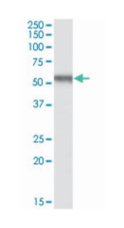 EGR2, Goat, Polyclonal Antibody, Abnova 100 &mu;g | Buy Online | Abnova Corporation | Fisher Scientific
