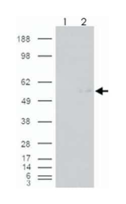 GCNT3 Goat anti-Human, Polyclonal Antibody, Abnova 100 &mu;g | Buy Online | Abnova Corporation | Fisher Scientific