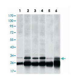 PSMB8, Mouse, Clone: 1A5, Abnova 100&mu;L; Unlabeled:Antibodies, Monoclonal