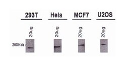 BRCA1, Mouse, Clone: RAY, Abnova 100&mu;L; Unlabeled:Antibodies, Monoclonal