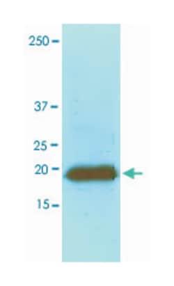 MYL2, Mouse, Clone: AT3B2, Abnova 100&mu;L; Unlabeled:Antibodies, Monoclonal