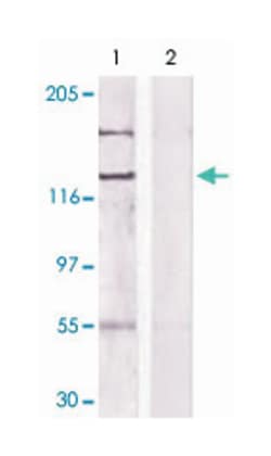 CSF1R Rabbit anti-Human, Mouse, Rat, Polyclonal Antibody, Abnova 100 &mu;g | Buy Online | Abnova Corporation | Fisher Scientific