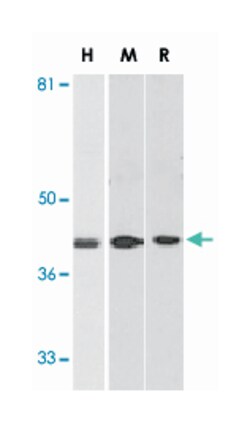 DAPK2 Rabbit anti-Human, Mouse, Rat, Polyclonal Antibody, Abnova 100&mu;g;