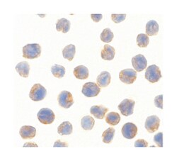TBK1, Rabbit, Polyclonal Antibody, Abnova 100&mu;g; Unlabeled:Antibodies,