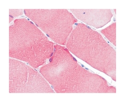 NOL3 Rabbit anti-Human, Polyclonal Antibody, Abnova 100&mu;g; Unlabeled:Antibodies,