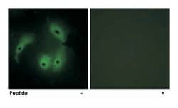 AKAP14, Rabbit, Polyclonal Antibody, Abnova 100&mu;g; Unlabeled:Antibodies,