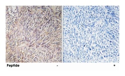 FGF22 Rabbit anti-Human, Mouse, Rat, Polyclonal Antibody, Abnova 100&mu;g;