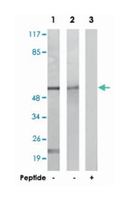 CAMK2A/CAMK2D, Rabbit, Polyclonal Antibody, Abnova 100&mu;g; Unlabeled:Antibodies,