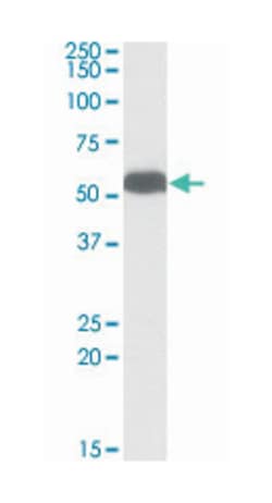 GLUD1/GLUD2, Goat, Polyclonal Antibody, Abnova 100&mu;g; Unlabeled:Antibodies,