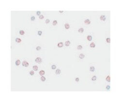 ATP11B, Rabbit, Polyclonal Antibody, Abnova 100&mu;g; Unlabeled:Antibodies,