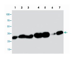 PDPN Rabbit anti-Human, Polyclonal Antibody, Abnova 100 &mu;g | Buy Online | Abnova Corporation | Fisher Scientific