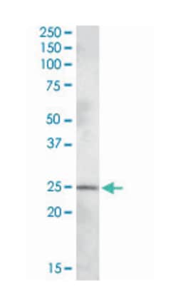 PLEKHB1, Goat, Polyclonal Antibody, Abnova 100&mu;g; Unlabeled:Antibodies,