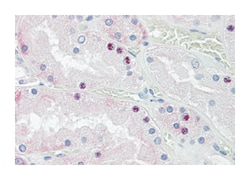 HOXD10, Goat, Polyclonal Antibody, Abnova 100 &mu;g | Buy Online | Abnova Corporation | Fisher Scientific
