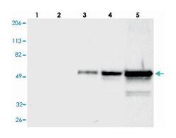 FGB Rabbit anti-Human, Polyclonal Antibody, Abnova 100 &mu;L | Buy Online | Abnova Corporation | Fisher Scientific