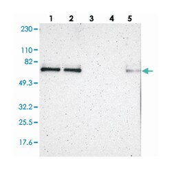 ZNF384, Rabbit, Polyclonal Antibody, Abnova 100 &mu;L | Buy Online | Abnova Corporation | Fisher Scientific