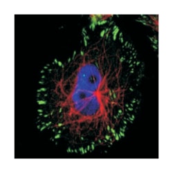 SDC1 Rabbit anti-Human, Polyclonal Antibody, Abnova 100&mu;L; Unlabeled:Antibodies,
