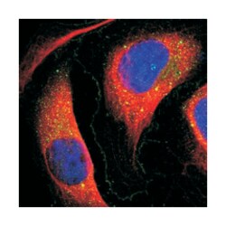 FAM176A, Rabbit, Polyclonal Antibody, Abnova 100&mu;L; Unlabeled:Antibodies,