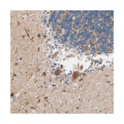 KLHDC8B Rabbit anti-Human, Polyclonal Antibody, Abnova 100 &mu;L | Buy Online | Abnova Corporation | Fisher Scientific