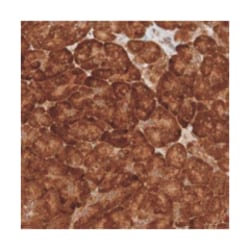 MRPL52, Rabbit, Polyclonal Antibody, Abnova 100&mu;L; Unlabeled:Antibodies,