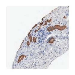 KLHL28, Rabbit, Polyclonal Antibody, Abnova 100 &mu;L | Buy Online | Abnova Corporation | Fisher Scientific