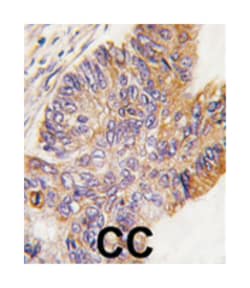 RPS6KA1 Rabbit anti-Human, Polyclonal Antibody, Abnova 400 &mu;L | Buy Online | Abnova Corporation | Fisher Scientific