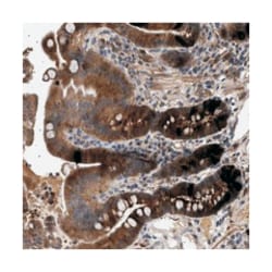 GUCY1B3 Rabbit anti-Human, Polyclonal Antibody, Abnova 100&mu;L; Unlabeled:Antibodies,