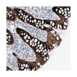 MKS1 Rabbit anti-Human, Polyclonal Antibody, Abnova 100 &mu;L | Buy Online | Abnova Corporation | Fisher Scientific