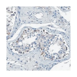 ANKFN1 Rabbit anti-Human, Polyclonal Antibody, Abnova 100&mu;L; Unlabeled:Antibodies,