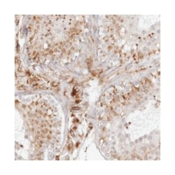 TCTEX1D1 Rabbit anti-Human, Polyclonal Antibody, Abnova 100 &mu;L | Buy Online | Abnova Corporation | Fisher Scientific