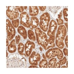 CPSF3L Rabbit anti-Human, Mouse, Rat, Polyclonal Antibody, Abnova 100&mu;L;