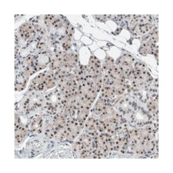 DNAJC6, Rabbit, Polyclonal Antibody, Abnova 100&mu;L; Unlabeled:Antibodies,
