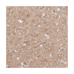 NALCN Rabbit anti-Human, Polyclonal Antibody, Abnova 100 &mu;L | Buy Online | Abnova Corporation | Fisher Scientific
