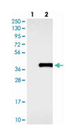 COLEC11, Rabbit, Polyclonal Antibody, Abnova 100&mu;L; Unlabeled:Antibodies,