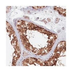 KIF17, Rabbit, Polyclonal Antibody, Abnova 100 &mu;L | Buy Online | Abnova Corporation | Fisher Scientific