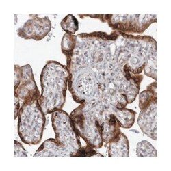 MAP7D3, Rabbit, Polyclonal Antibody, Abnova 100 &mu;L | Buy Online | Abnova Corporation | Fisher Scientific