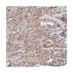 LRCH4 Rabbit anti-Human, Polyclonal Antibody, Abnova 100 &mu;L | Buy Online | Abnova Corporation | Fisher Scientific
