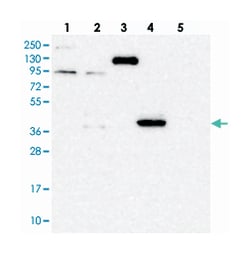 PDSS1, Rabbit, Polyclonal Antibody, Abnova 100μL; Unlabeled:Antibodies,