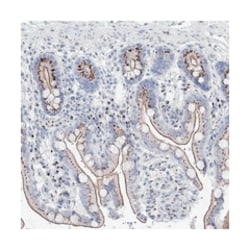 TMEM165, Rabbit, Polyclonal Antibody, Abnova 100 &mu;L | Buy Online | Abnova Corporation | Fisher Scientific