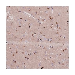 ADO Rabbit anti-Human, Polyclonal Antibody, Abnova 100 &mu;L | Buy Online | Abnova Corporation | Fisher Scientific