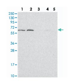 BCO2 Rabbit anti-Human, Polyclonal Antibody, Abnova 100&mu;L; Unlabeled:Antibodies,