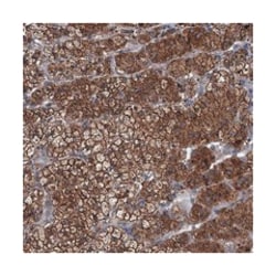 AGRN, Rabbit, Polyclonal Antibody, Abnova 100 &mu;L | Buy Online | Abnova Corporation | Fisher Scientific