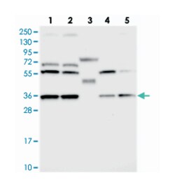 DNAJC17 Rabbit anti-Human, Polyclonal Antibody, Abnova 100 &mu;L | Buy Online | Abnova Corporation | Fisher Scientific