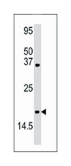 SUMO4 Rabbit anti-Human, Polyclonal Antibody, Abnova 400 &mu;L | Buy Online | Abnova Corporation | Fisher Scientific