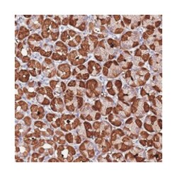SPCS1, Rabbit, Polyclonal Antibody, Abnova 100&mu;L; Unlabeled:Antibodies,