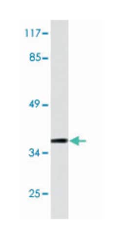 IgA Rabbit anti-Human, Polyclonal Antibody, Abnova 100&mu;L; Unlabeled:Antibodies,
